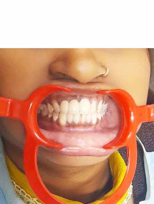 SMILE TRANSFORMATION