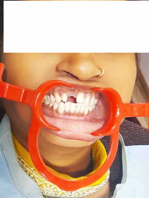 SMILE TRANSFORMATION