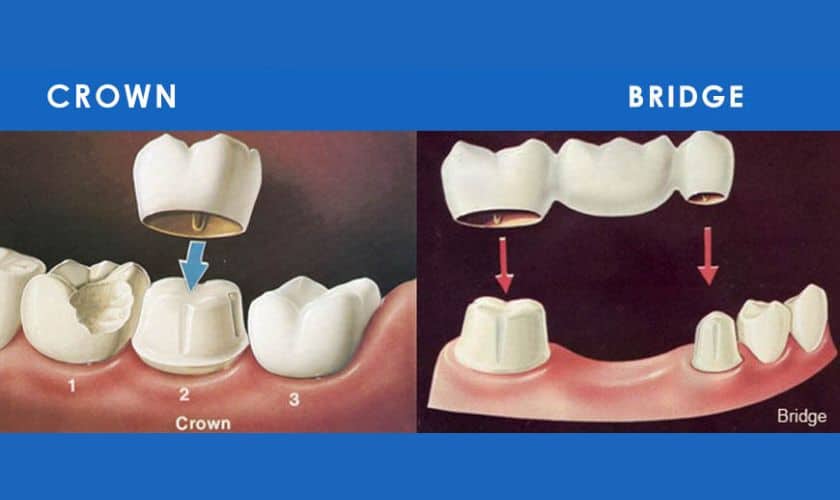 Orthodontics in Patna